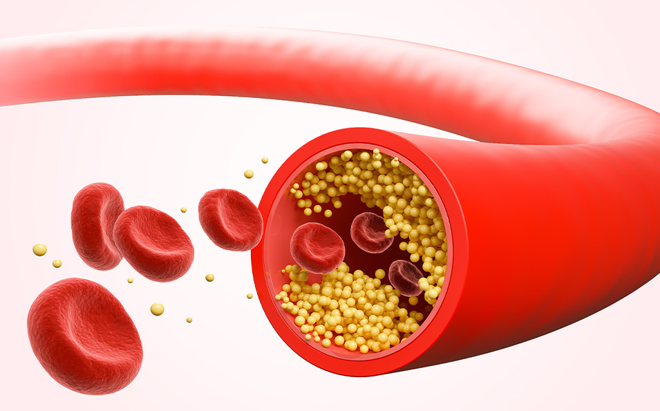 Drugs For The Cardiovascular System